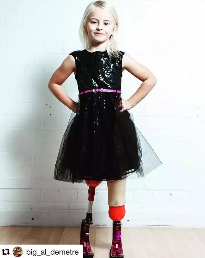 因为卫生棉条被截肢,女星因为卫生巾截肢