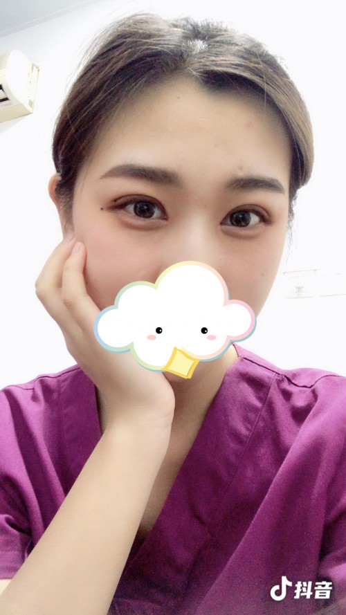 修志夫做双眼皮效果怎么样,修志夫双眼皮修复