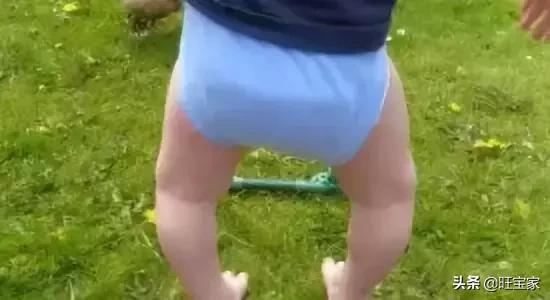 6岁小女孩罗圈腿,六岁女孩罗圈腿