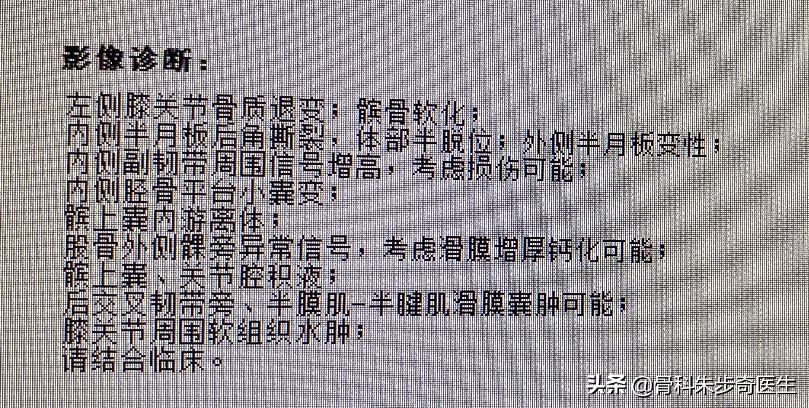 膝关节上面的骨刺该怎么解决,年轻人膝关节骨刺是怎样引起的
