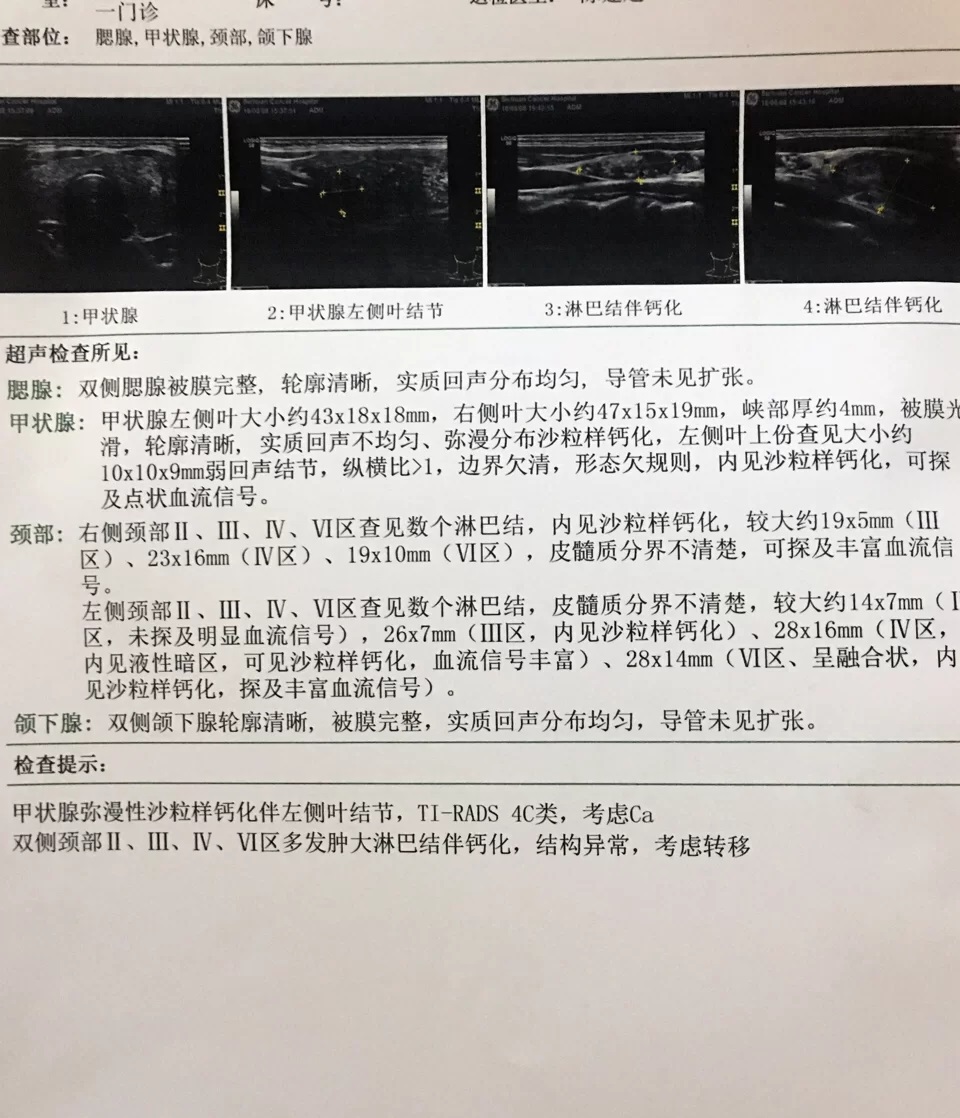 脖子疼痛是甲癌在扩散吗,右耳肿了淋巴结也痛