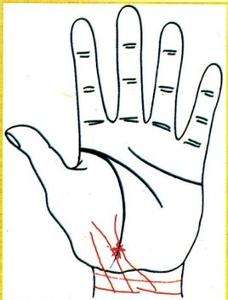 手掌中心有一点发黑什么原因,手掌里有部位发紫是怎么回事