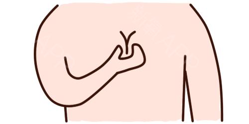 胸部一大一小是缺陷吗,胸一大一小是什么病