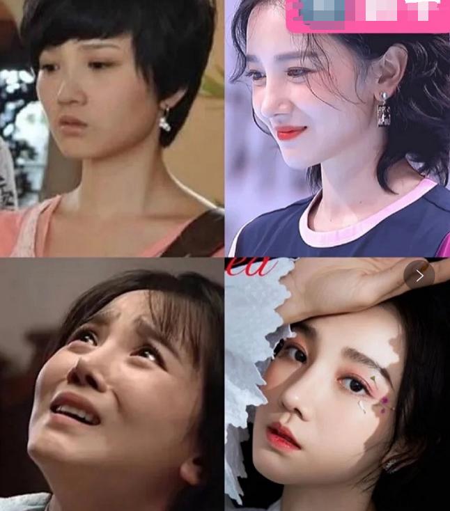 盘点一些有问题的鼻子,明星都没整好的鼻子