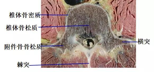 颈椎腰椎疾病ct及mri诊断,腰椎ct可以发现肠部病变吗