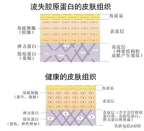 怎么遮眼纹和黑眼圈,黑眼圈眼纹很重显老怎么办