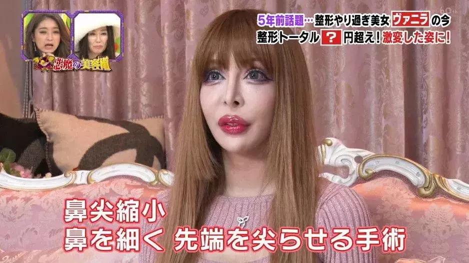 日本妹子花1286万元整容成芭比娃娃?!见识到了“可怕”……