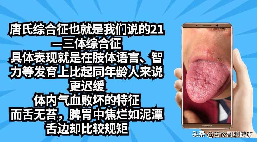 舌诊哥肝郁脾虚,抖音舌诊哥的感悟