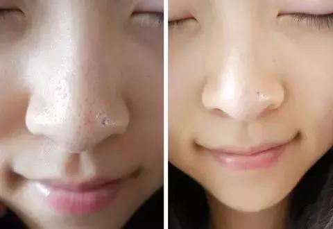 护肤反而皮肤差,改掉这些护肤恶习让你越变越美丽