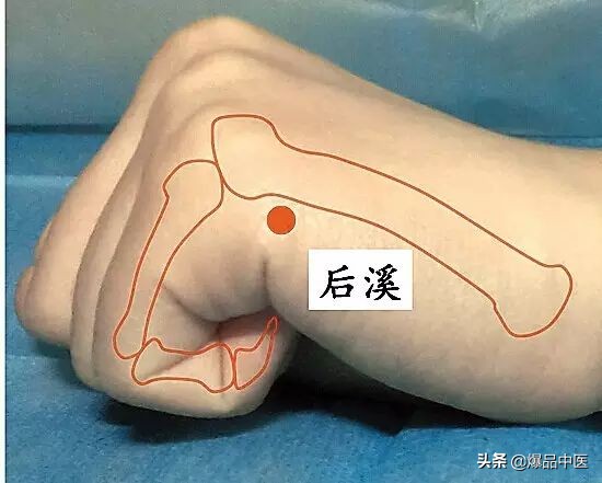 气虚型冠心病缓不过来气的急救穴,中医对心脏病的急救用穴是哪几个