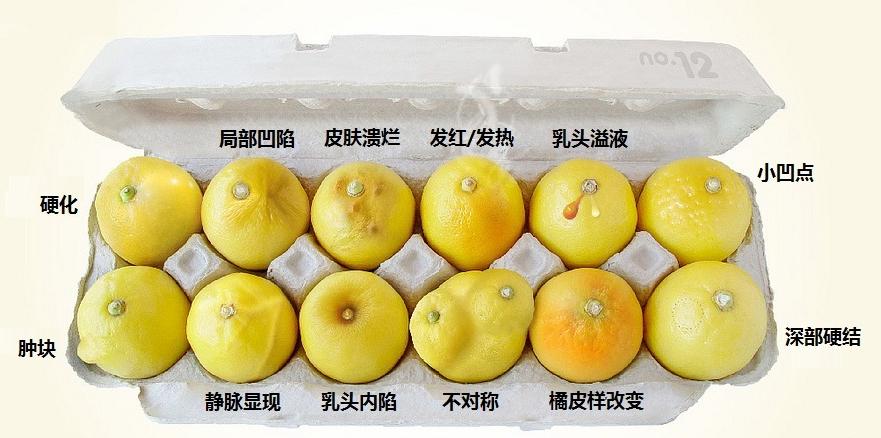 乳房自检有什么预兆,乳房自检在什么时候