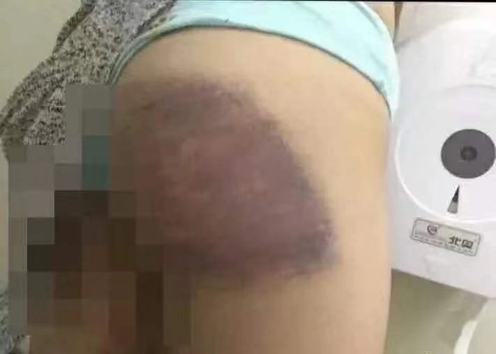 杨永信和豫章书院受害者,豫章书院杨永信结局