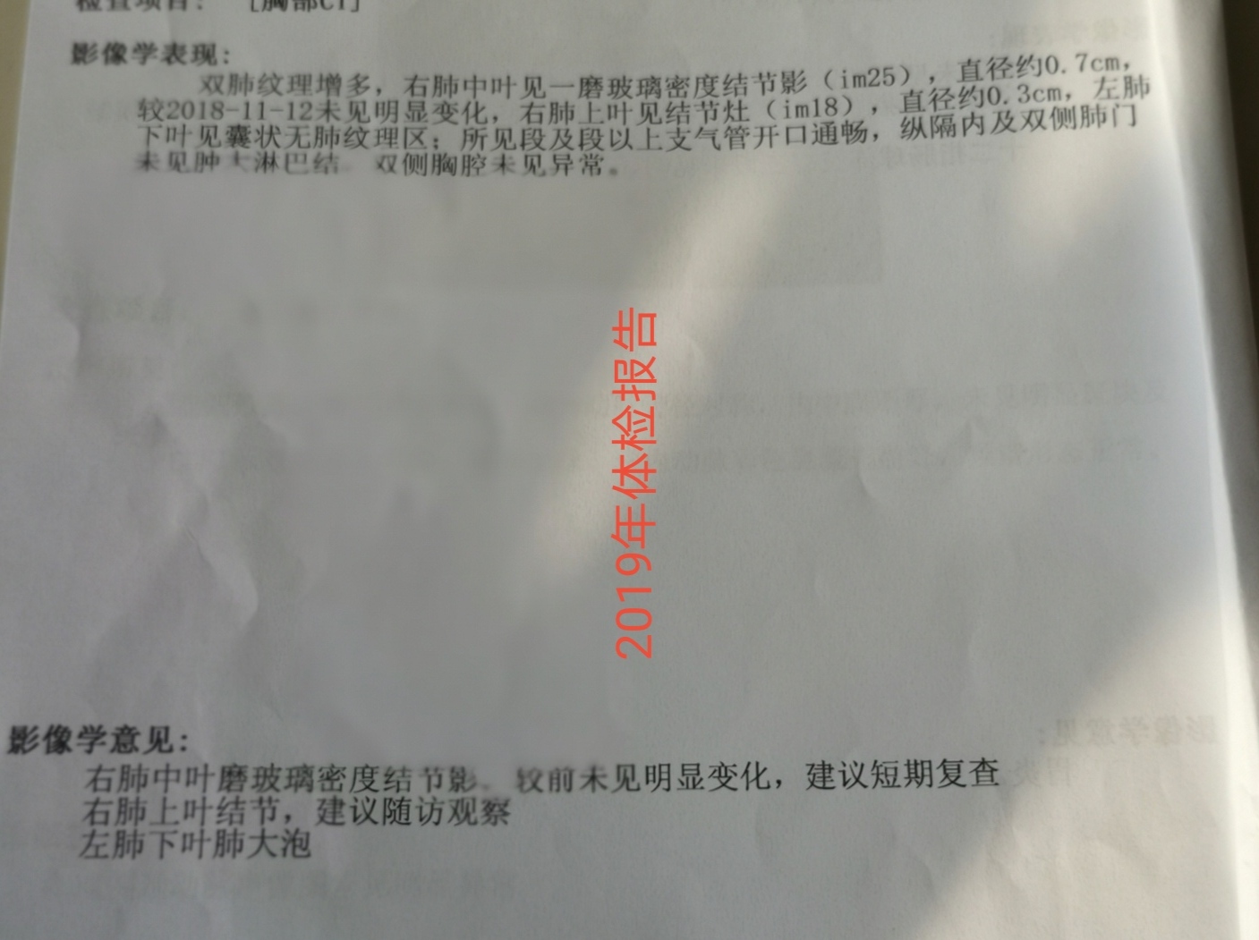 肺癌都是从磨玻璃开始的么,早期磨玻璃肺癌能治愈吗