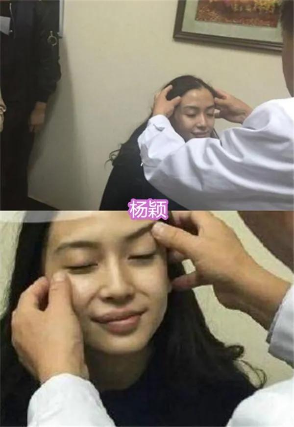 angelababy杨紫杨幂鞠婧祎,女星一再承认自己没有整容