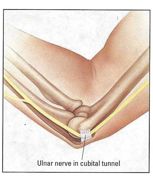 胳膊肘弯曲伸不直有10多年怎么办,胳膊肘转动但是不动