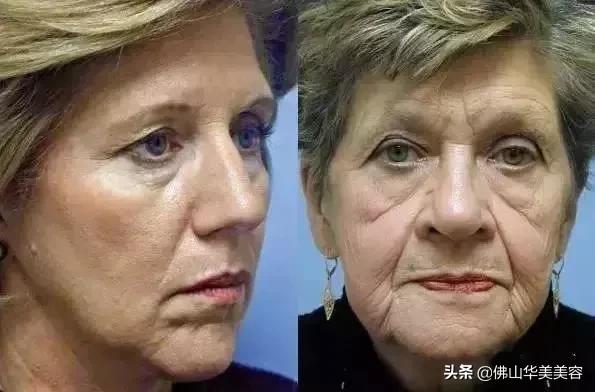 佛山禅城华美整形美容,佛山华美医疗美容高明