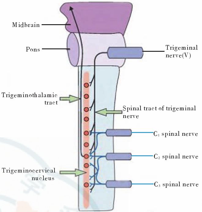 颈源性头痛诊断标准,颈源性头痛的诊断和治疗