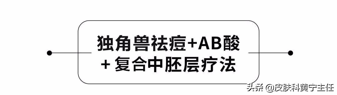 宅家的1个多月都没化妆，竟然还爆痘