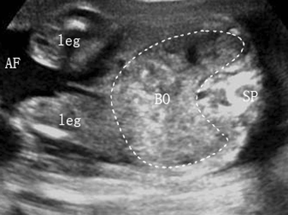 孕期不能忽视的胎儿超声检查,胎儿超声检查报告表