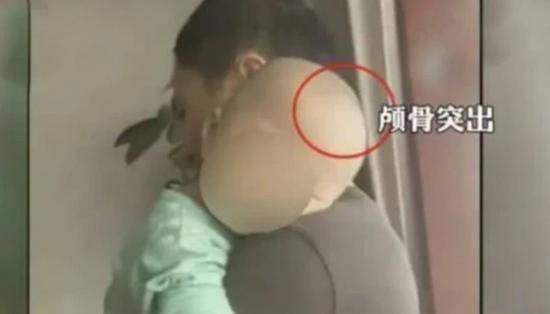 深扒这5种保健品是怎么骗人的,购买保健品要警惕小心被套路