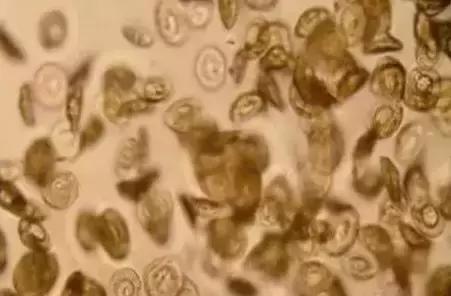 鱼类寄生虫有哪些,鱼类寄生虫的科普知识