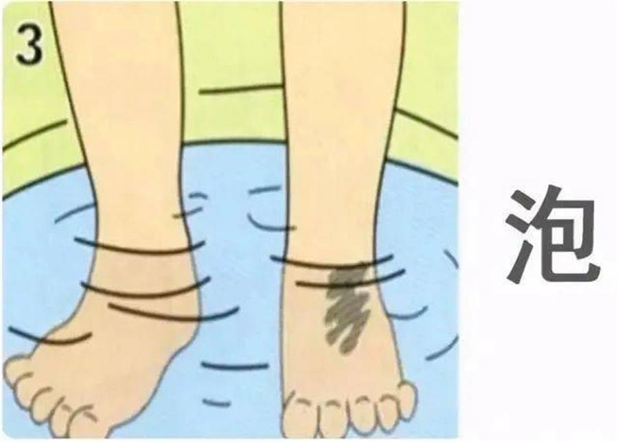 妈妈不小心被女孩烫伤,孩子被烫伤记住四件事情