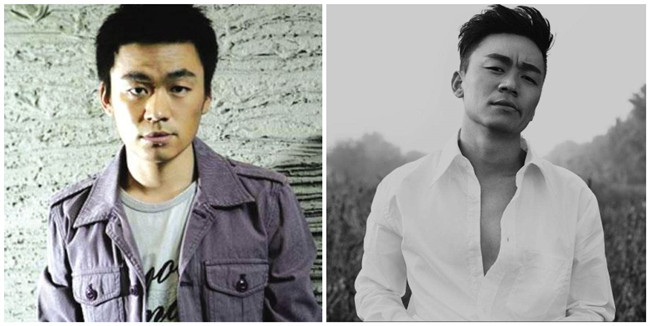 脱发谢顶发际线高,脱发谢顶补充什么营养