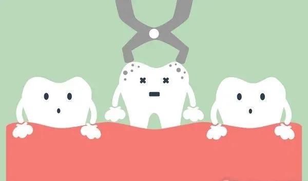 拔牙后很想睡觉为什么,拔牙后注意事项可以刷牙不