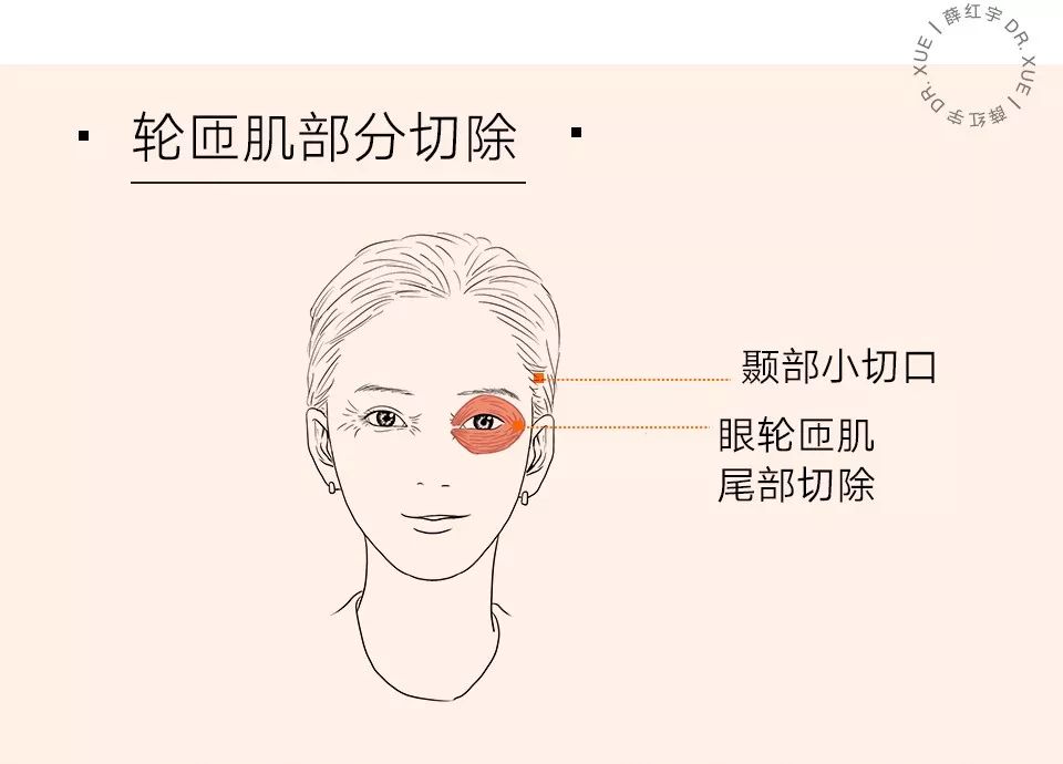 眼部抗衰最好方法,眼部抗衰效果图