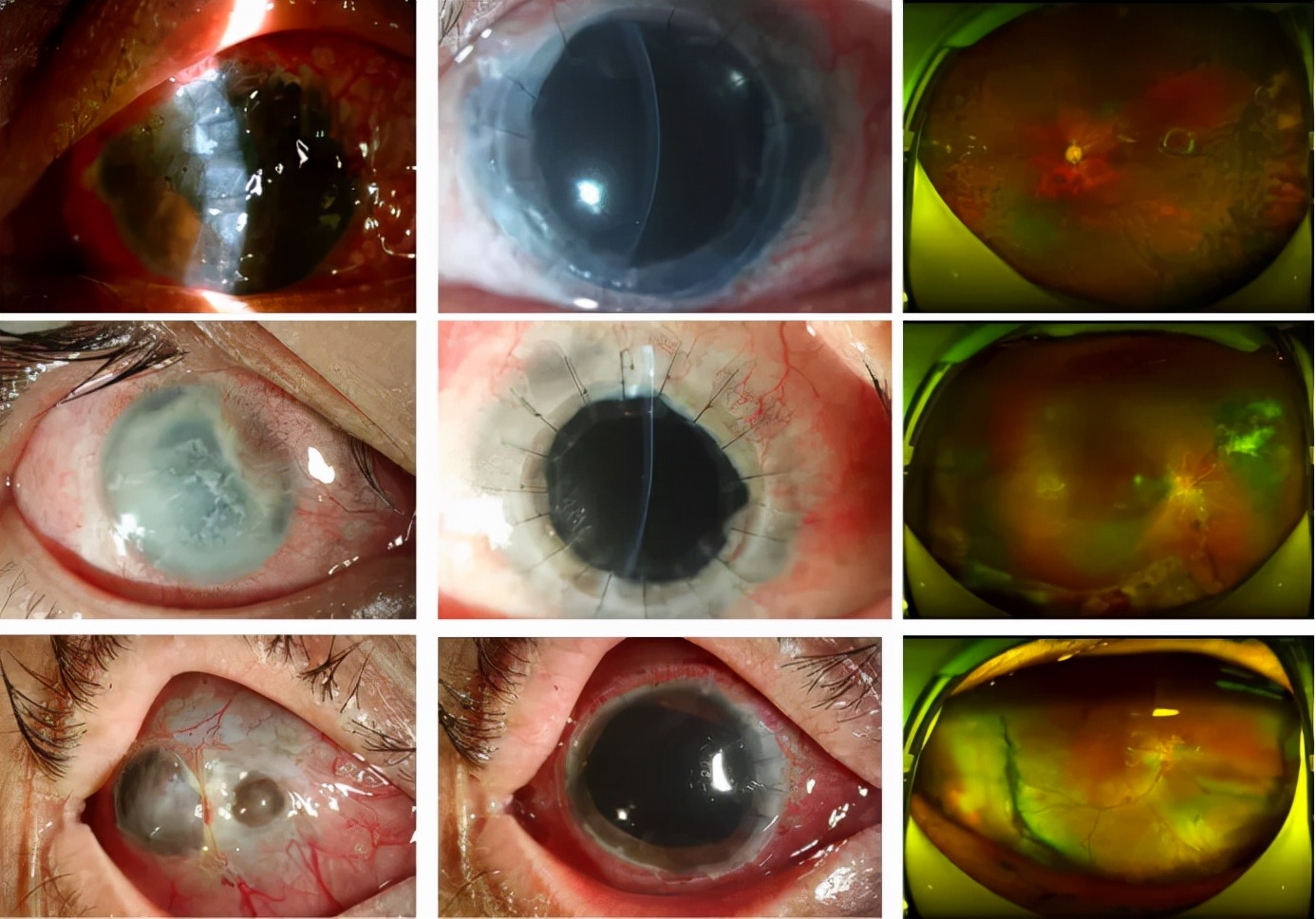 冯云眼科教授坐诊时间表,冯云教授简历