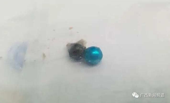 2岁幼儿连续三天上吐下泻,2岁宝宝不明原因上吐下泻