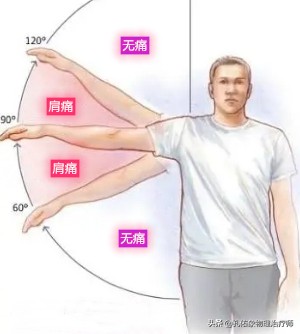 肩膀痛不知什么原因,教你一个动作解决肩膀疼痛