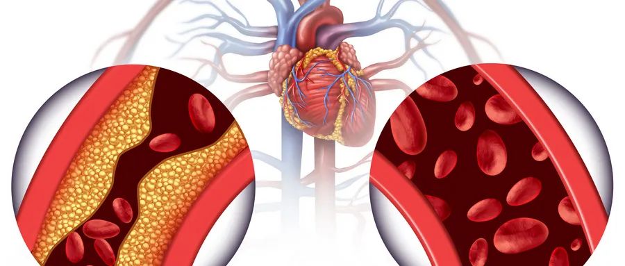 超敏c反应蛋白112严重吗,超敏c反应蛋白50什么意思