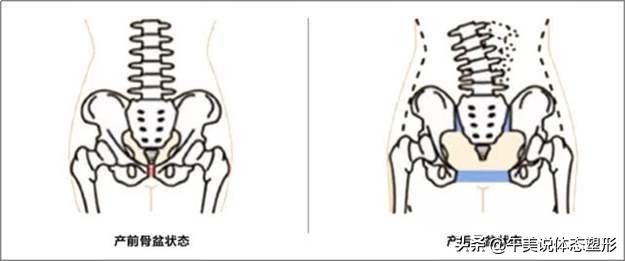 宝妈小腹突出怎么锻炼,宝妈肚子怎么练都紧致