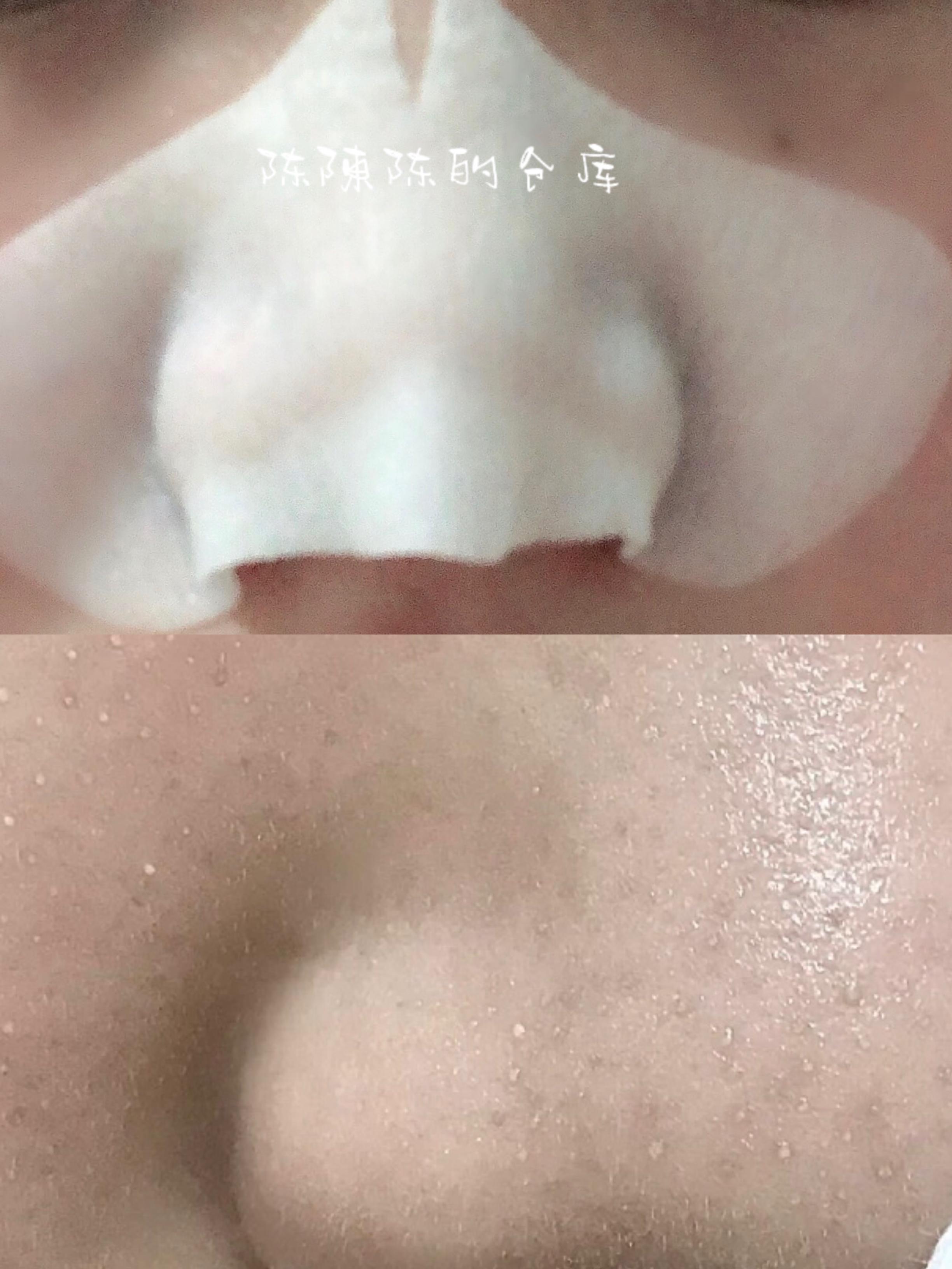 李佳琦安利的去黑头神器到底怎么样？我来替你们尝试了