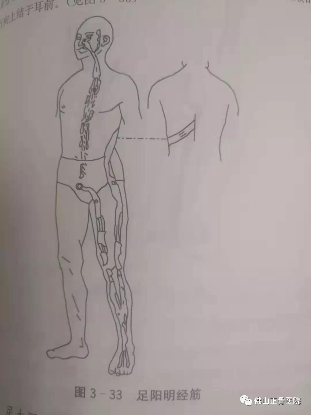 经筋手法，我院名誉院长国医大师韦贵康《韦氏骨伤手法集成》