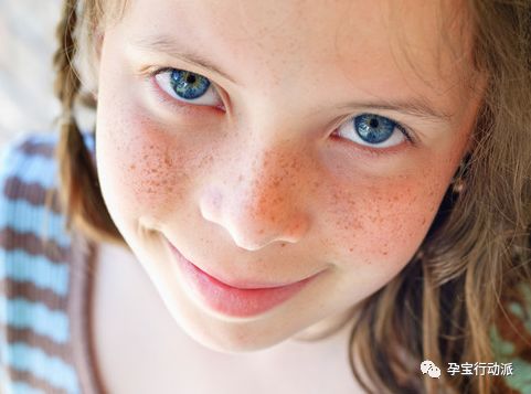 孕期长斑了怎么办,孕期长黑斑怎么办