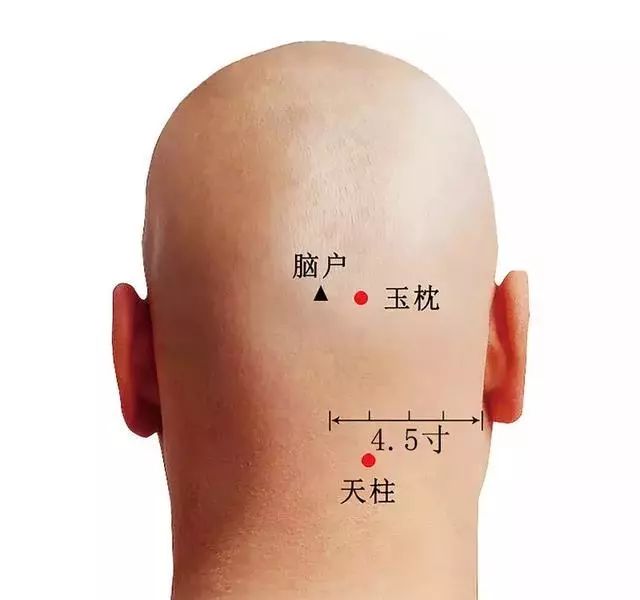 针灸治疗痛症的选穴原则,针灸奇穴疗法大全