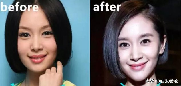 整容成小三,整容变美却嫁给丑八怪