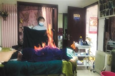 权健做火疗,权健火疗技术