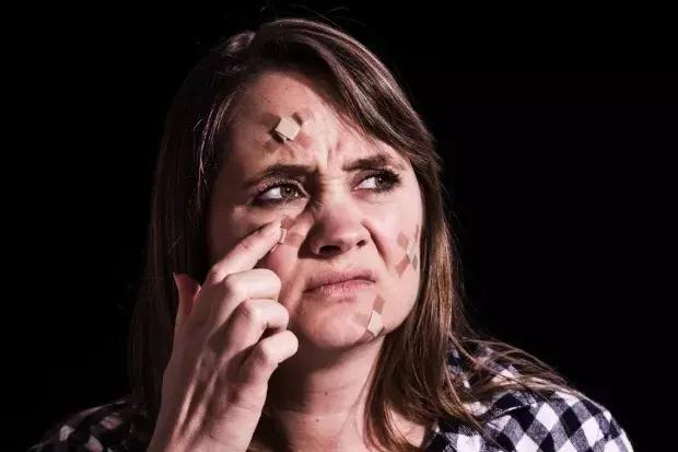 10年长痘经验,10年长痘趁早治