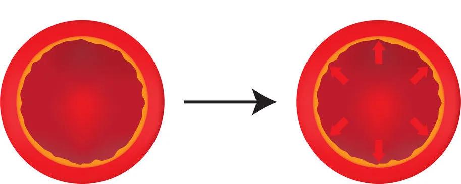 自测血压能查出什么病,血压高如何自测血管