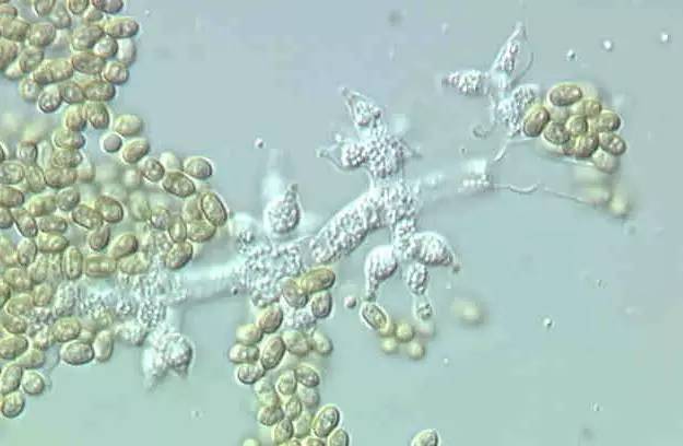 木霉菌到底是何方神圣?它是怎样防治病害的?