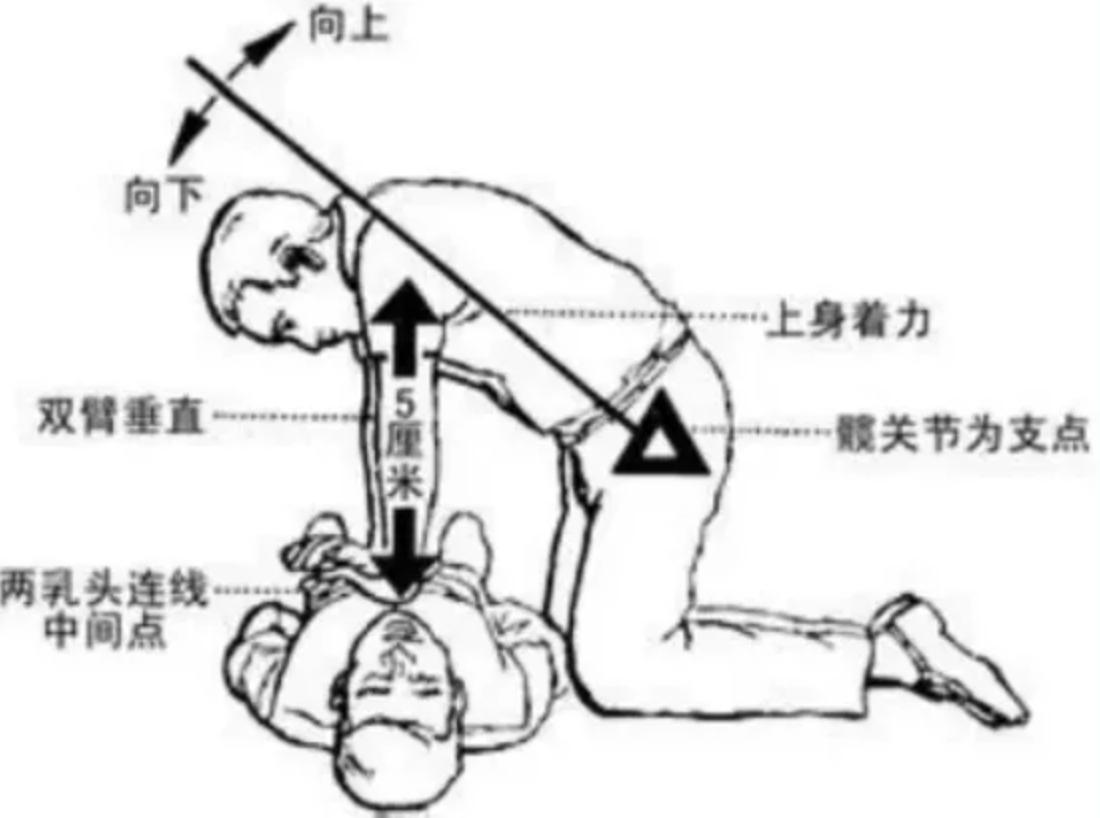 每年54.4万人心脏猝死，平均每分钟1例。三甲心内医生教你急救