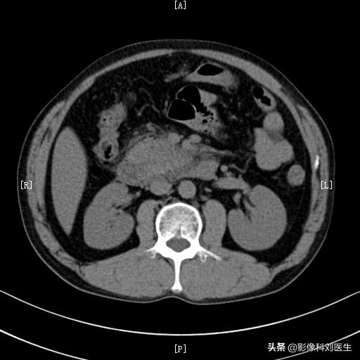暴饮暴食导致胃脘胀满疼痛,暴饮暴食引起的腹部疼痛怎么缓解