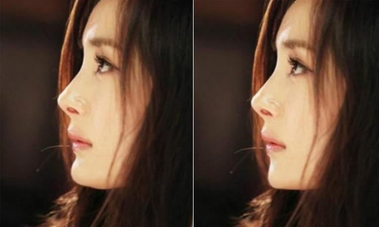 侧面好看和正面好看哪个好,女生侧面怎么才好看