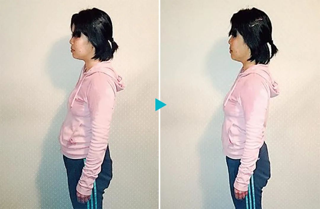 酸奶干对身体有什么好处,酸奶功效作用