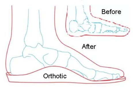 脚扭时听到嘎嘣一声响,脚扭了嘎吱一声