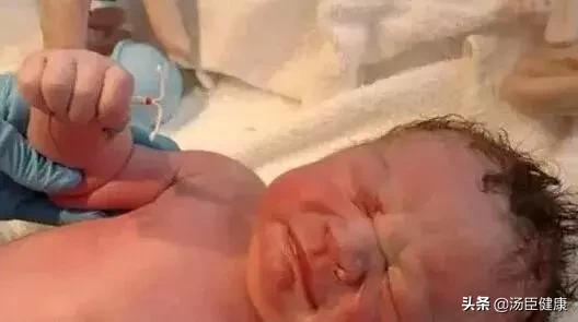 做了措施预防还会怀孕吗,做好措施了怀孕的几率有多大