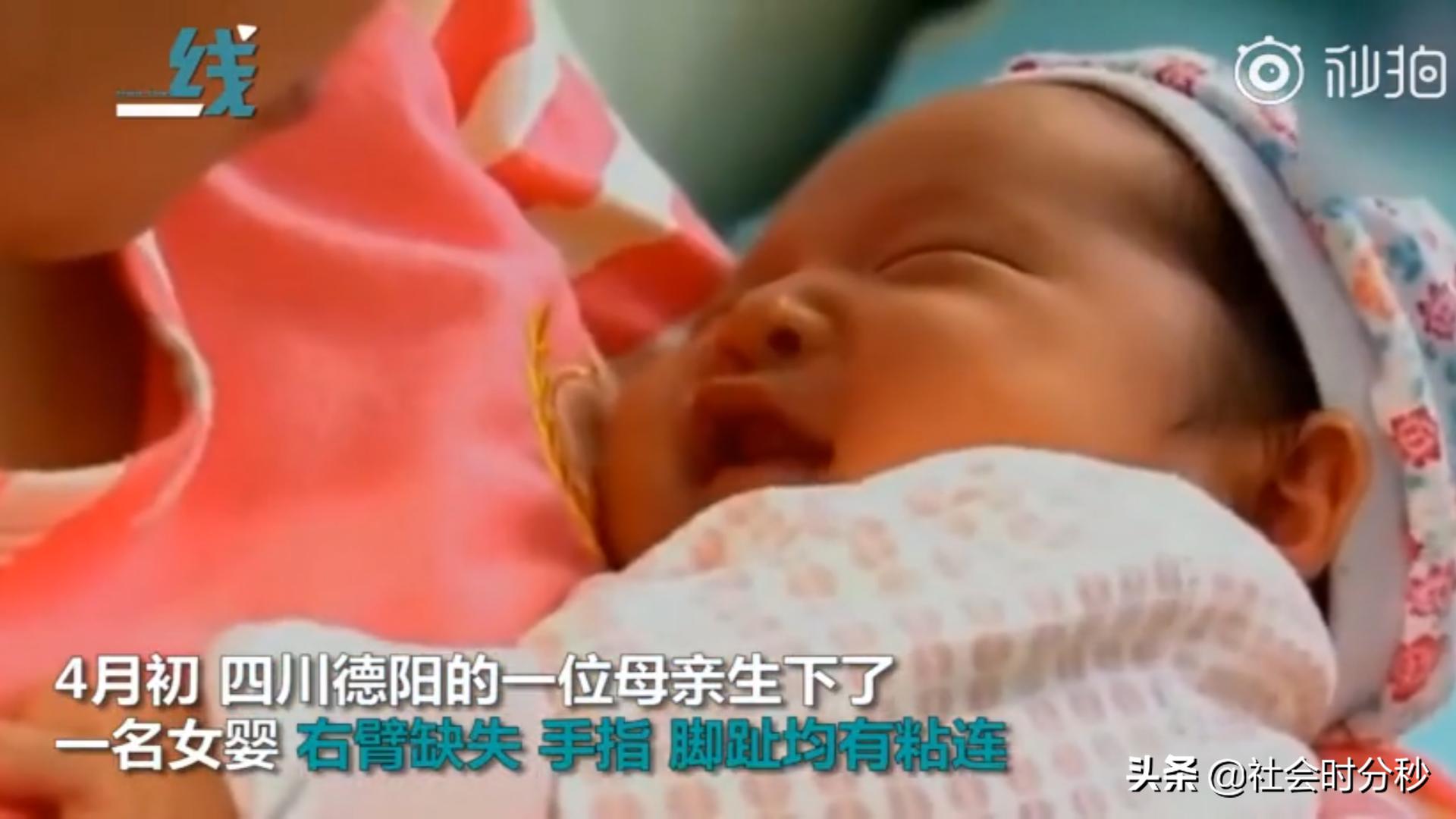 产检中发现胎儿手指缺失,孕检没查出来孩子生下来手指缺陷